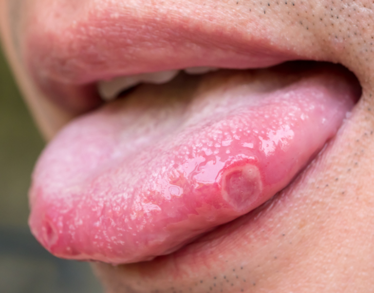 Dilinizin size sağlığınız hakkında anlatmaya çalıştığı 9 şey! Yanma hissi varsa...