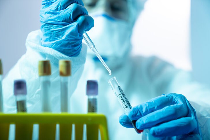 Hiçbir belirti yokken test yaptırdı, sonuç pozitif çıktı!