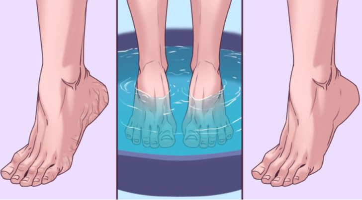 Ağız gargarasıyla ayakları yıkamanın 3 faydası! Nasır ve ağrılar için...