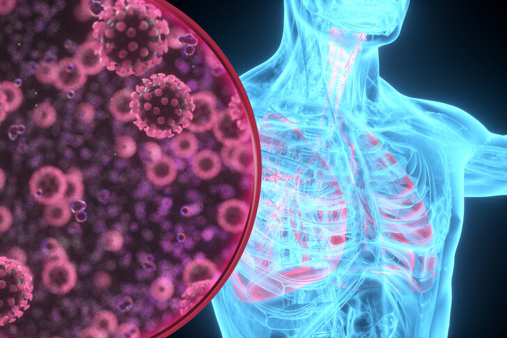 Akciğer kanseri uyarısı: Pandemi döneminde artış gözleniyor