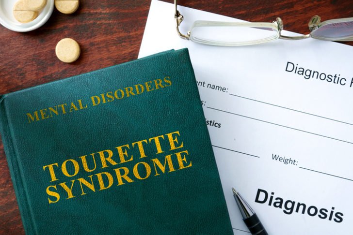 Tourette sendromu nedir, hangi şartlarda oluşur?