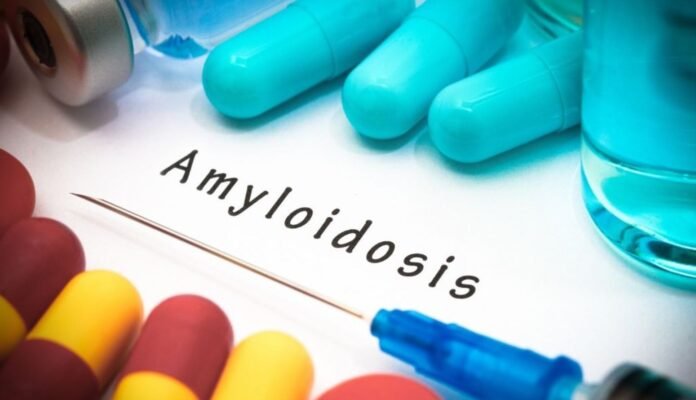 Amiloidoz