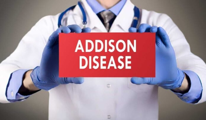 Addison Hastalığı Nedir? Belirtileri, Nedenleri ve Tedavisi