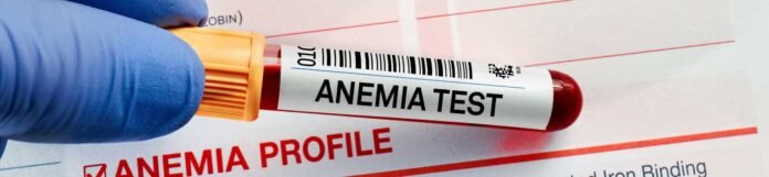 Kansızlık (Anemi) Nedir? Kansızlık Belirtileri Nelerdir?