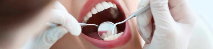 Diş Kökü İltihabı ( Diş Kökü Enfeksiyonu) nedir?