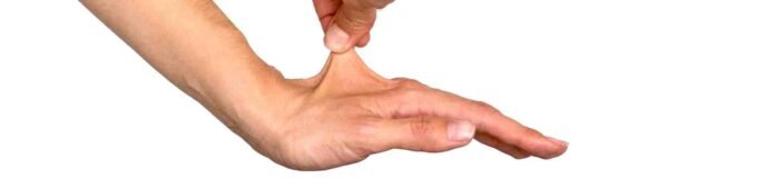 Ehlers-Danlos Sendromu Nedir? Belirtileri ve Tedavisi