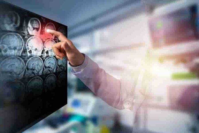 Hemipleji Nedir? Nedenleri, Belirtileri ve Tedavisi