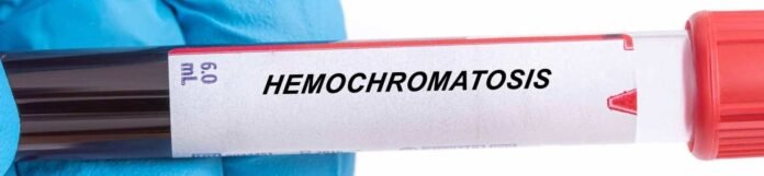 Hemokromatozis Nedir? Neden Olur, Belirtileri Nelerdir?