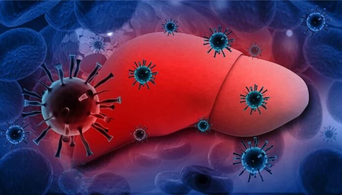 Hepatit B Nedir? Hepatit B Belirtileri Nelerdir, Nasıl Bulaşır?