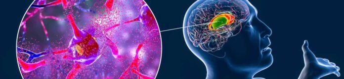 Huntington Hastalığı Nedir? Belirtileri, Nedenleri ve Tedavisi