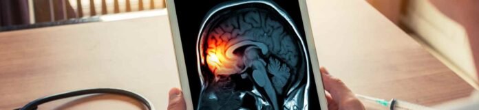 Menenjit Nedir? Menenjit Belirtileri, Nedenleri ve Tedavisi
