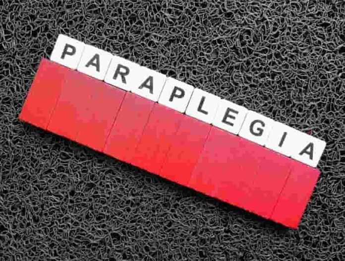 Parapleji (Omurilik felci) nedir?