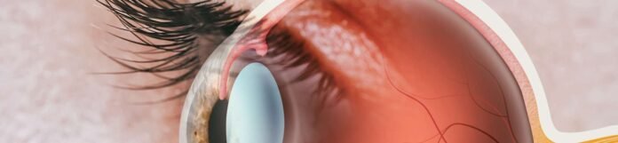 Retinopati Nedir? Retinopati Çeşitleri Nelerdir?