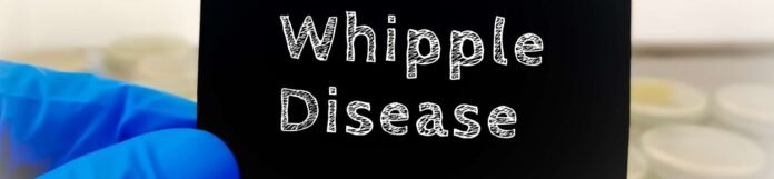 Whipple Hastalığı Nedir? Whipple Hastalığı Belirtileri